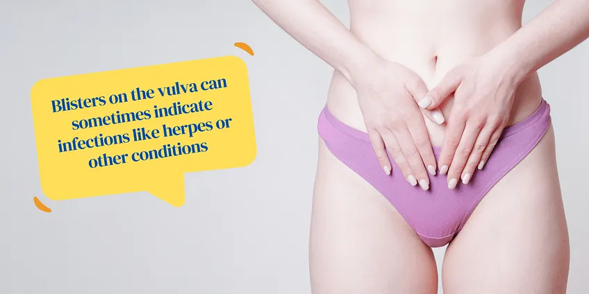 Spot A Gynaecological Cancer | Dr Manas Chakrabarti | Gynae Oncology And Gynaecological Surgery In Kolkata