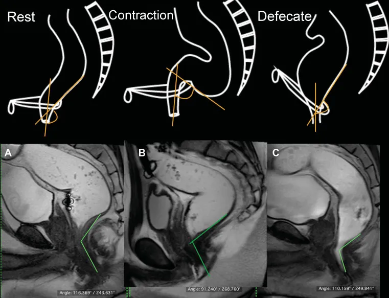 Art of Good Potty | Dr Manas Chakrabarti | Gynae Oncology And Gynaecological Surgery In Kolkata
